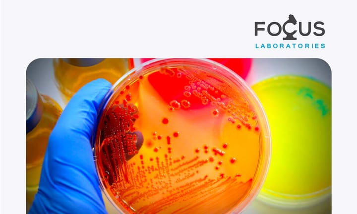 Various lab cultures in different colors.